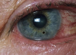 眼角膜照片,探寻生命的奥秘与美丽